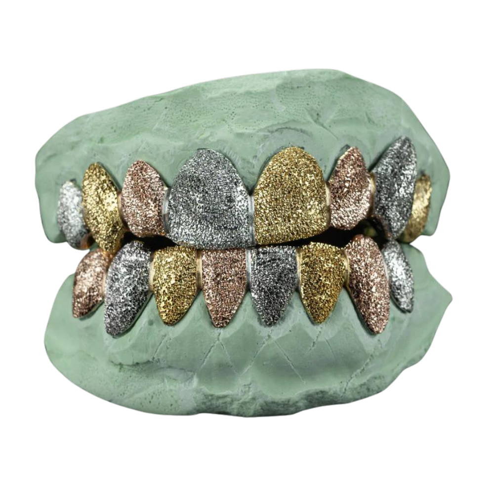 A set of tri-tone gold grillz with rose gold, white, and yellow gold colors, featuring ice cut and diamond dust details on a white background.